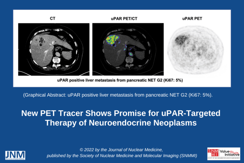 New PET Tracer Shows Promise for NENs - Oncidium Foundation